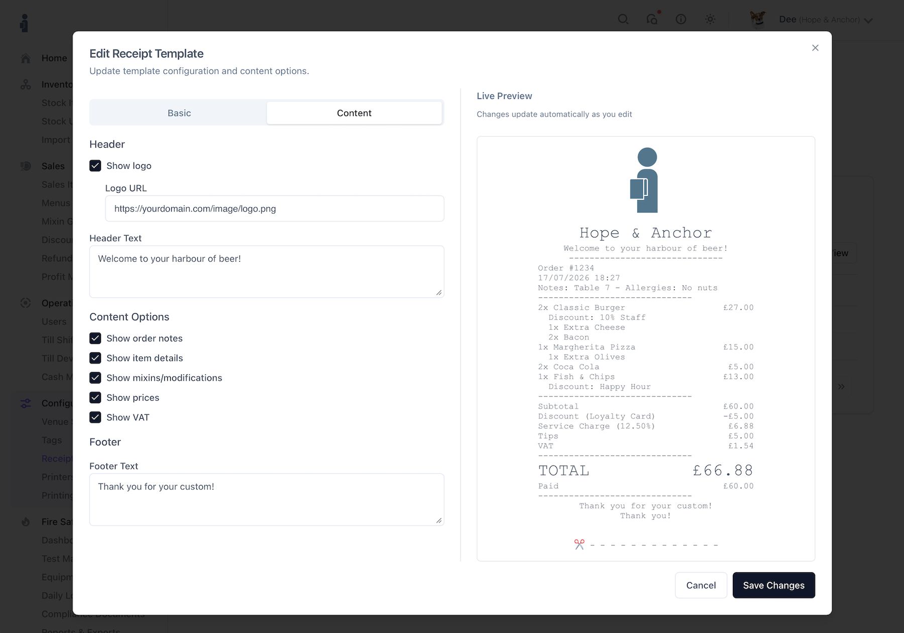 Receipt template designer in the HospIQ dashboard: edit panel and live receipt preview side by side